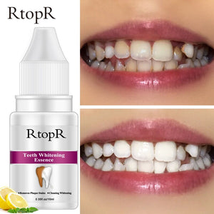 Top Teeth Whitening Essenz